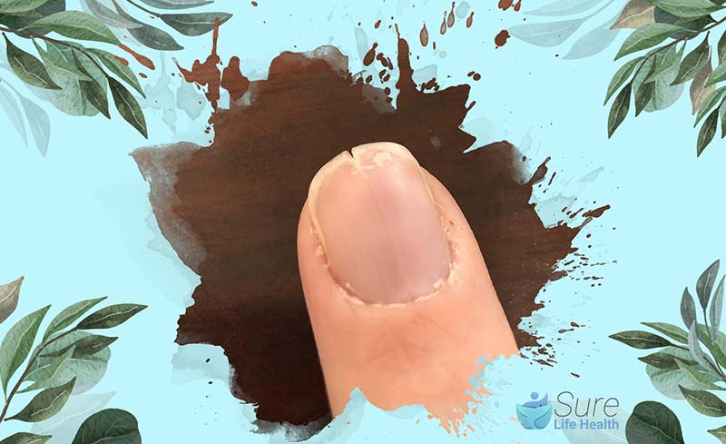 How to Repair a Split Nail Down the Middle